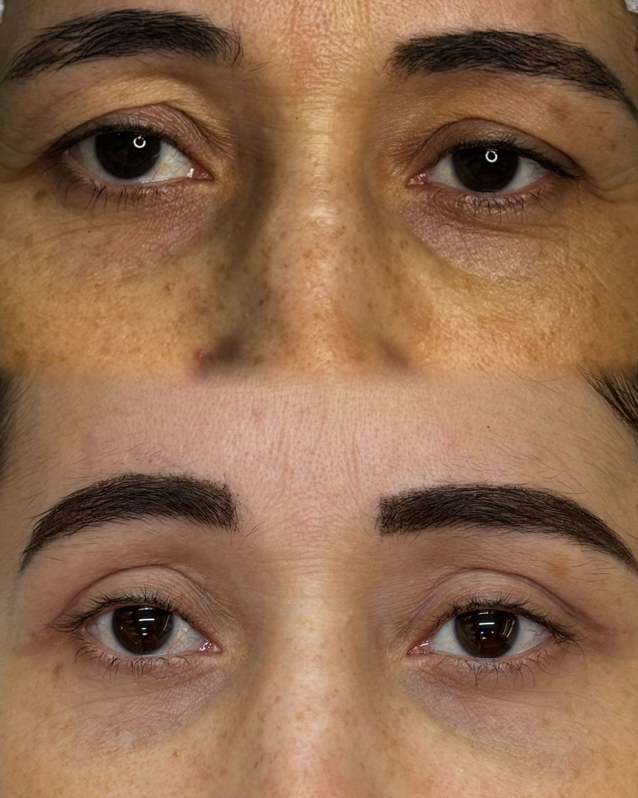 Testimony