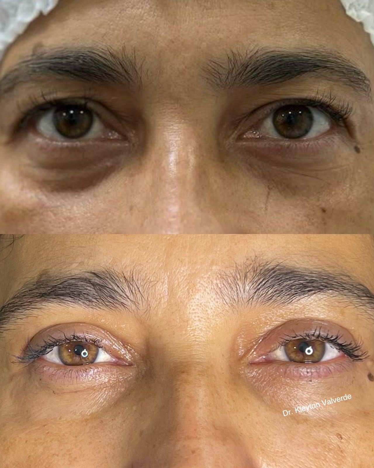 Testimony