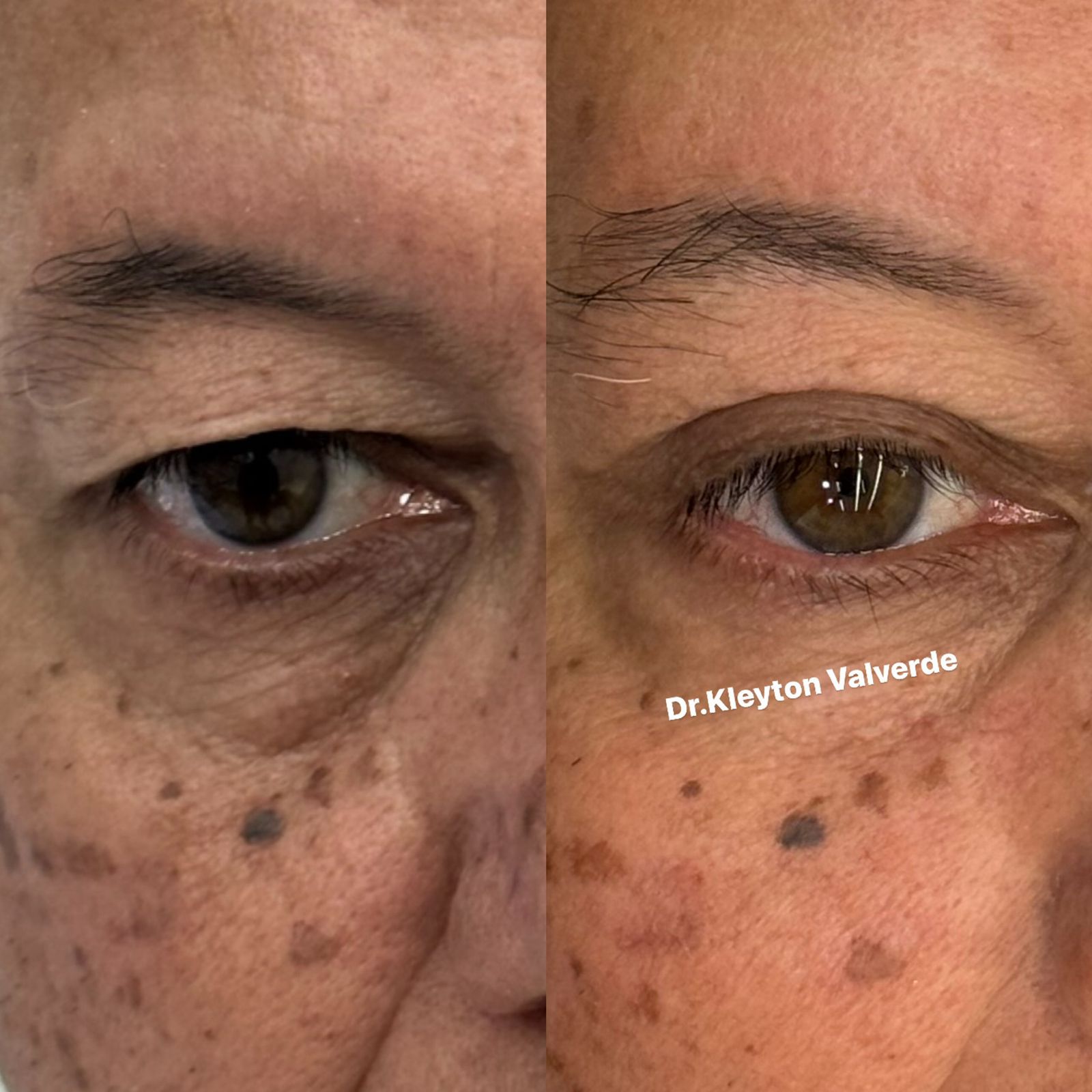 Testimony